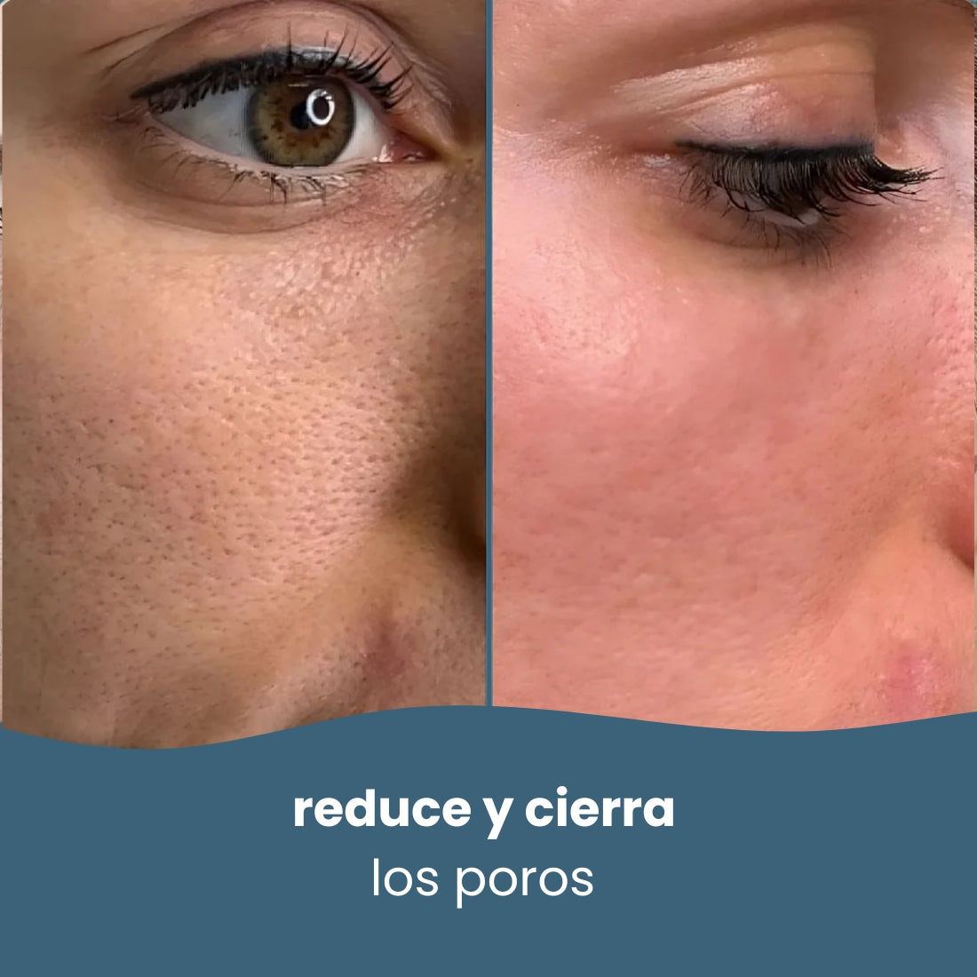 Limpiadores de ácido kójico y cúrcuma + Ebook planificador de Skin Care