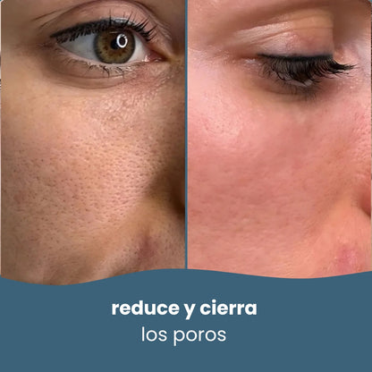 Limpiadores de ácido kójico y cúrcuma + Ebook planificador de Skin Care