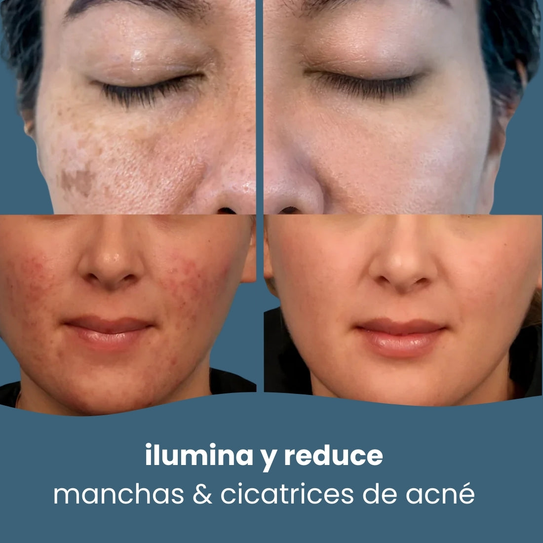 Limpiadores de ácido kójico y cúrcuma + Ebook planificador de Skin Care